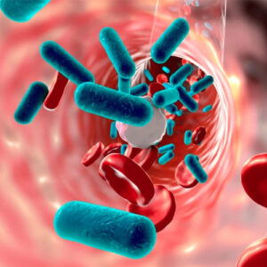 Bacteriële infecties